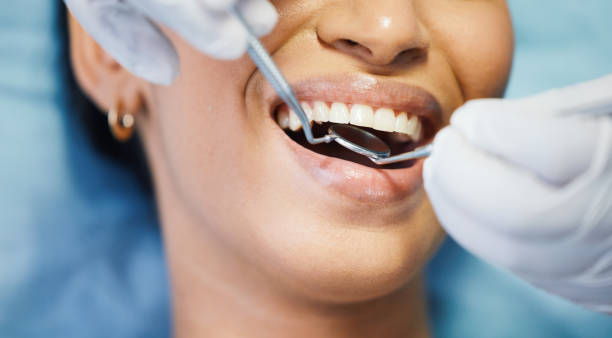 Best Emergency Dental Services for Seniors in Darby, PA